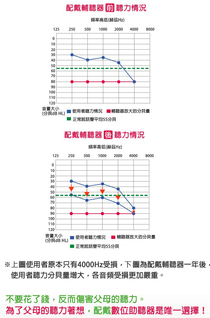 【EasyHear易耳通】數位藍芽助聽器(TC型號)