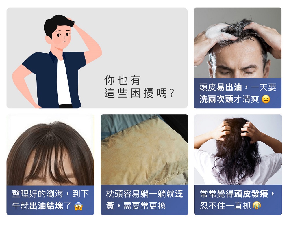 頭皮易出油,一天要