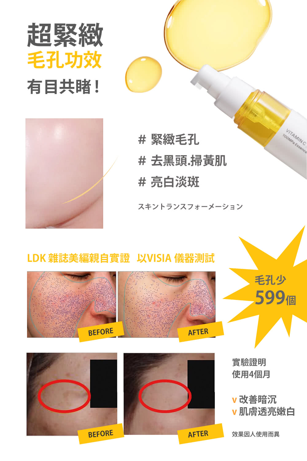 LDK 雜誌美編親自實證 VISIA 儀器測試