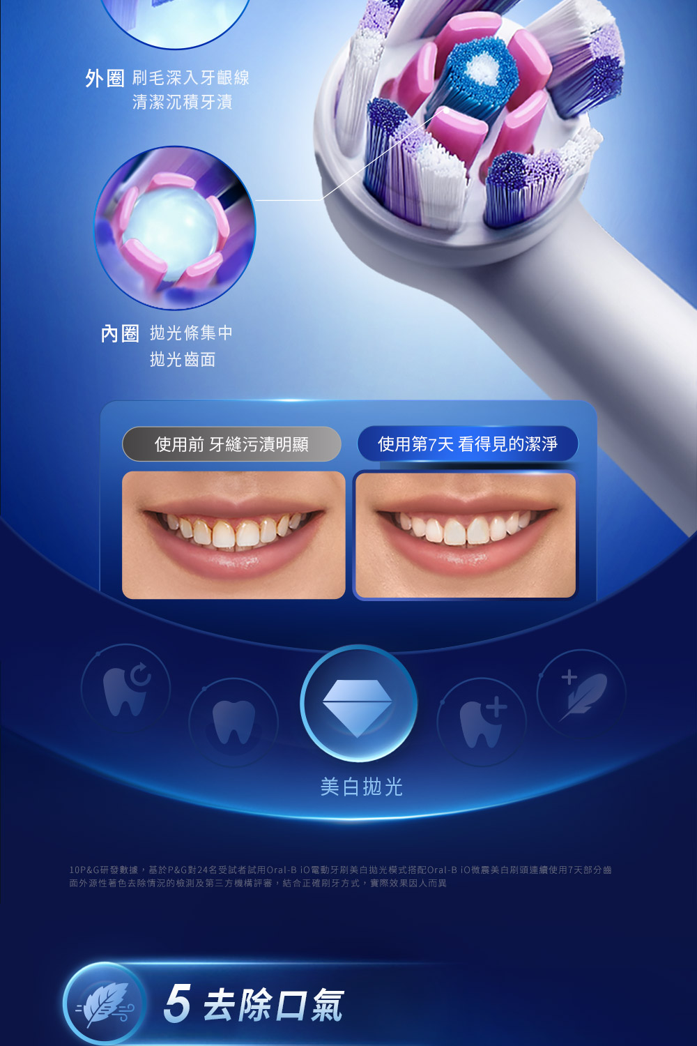 外圈 刷毛深入牙齦線清潔沉積牙漬 條集中拋光齒面使用前 牙縫污漬明顯使用第7天 看得見的潔淨美白抛光10P&G研發數據,基於P&G對24名受試者試用Oral-B 電動牙刷美白拋光模式搭配Oral-BiO微震美白刷頭連續使用7天部分齒面外源性著色去除情況的檢測及第三方機構評審,結合正確刷牙方式,實際效果因人而異5去除口氣