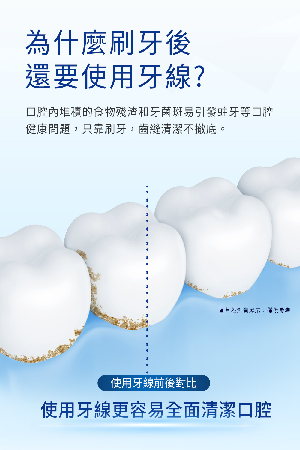 口腔內堆積的食物殘渣和牙菌斑易引發蛀牙等口腔