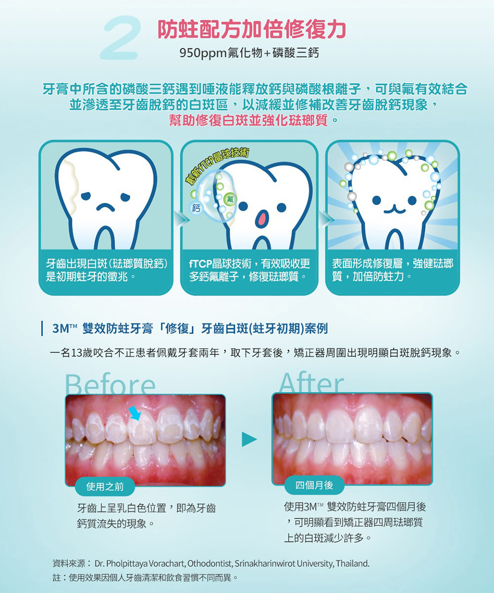 資料來源Dr. Pholpittaya Vorachart, Othodontist, Srinakharinwirot University, Thailand.