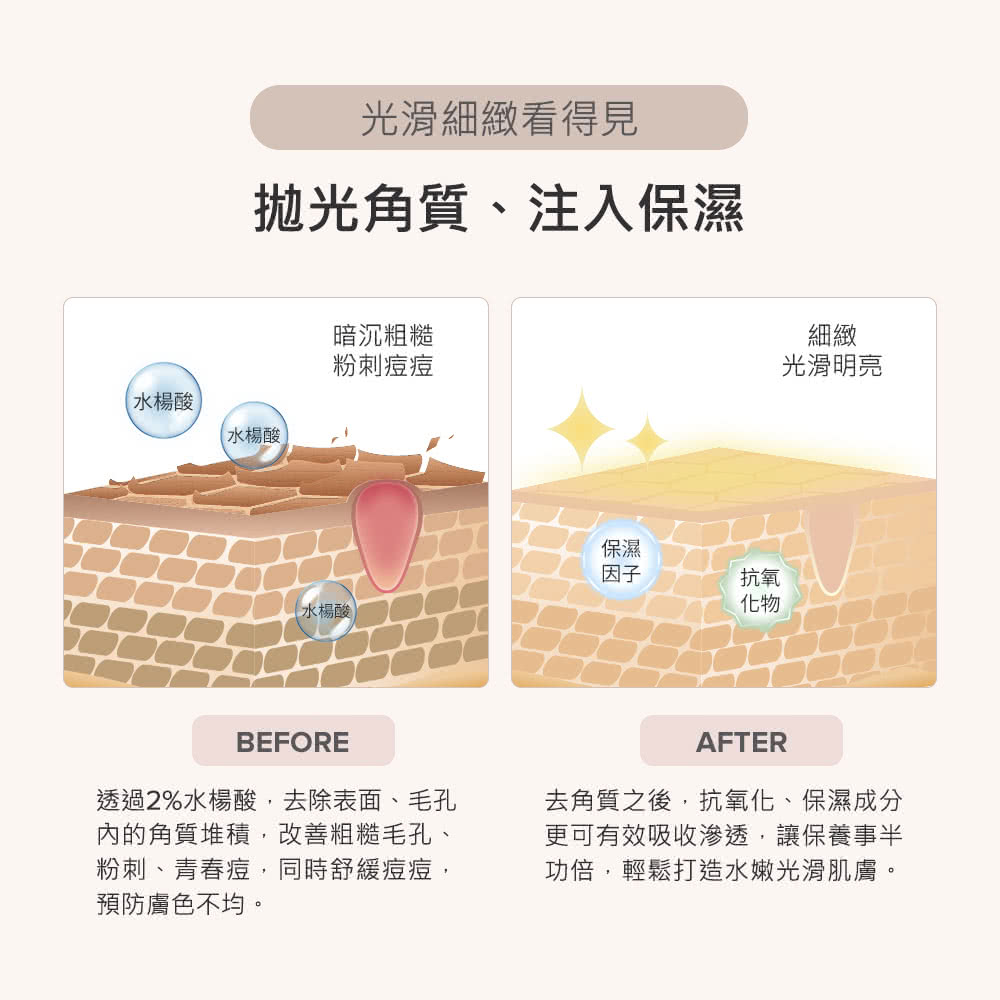 透過2%水楊酸,去除表面、毛孔