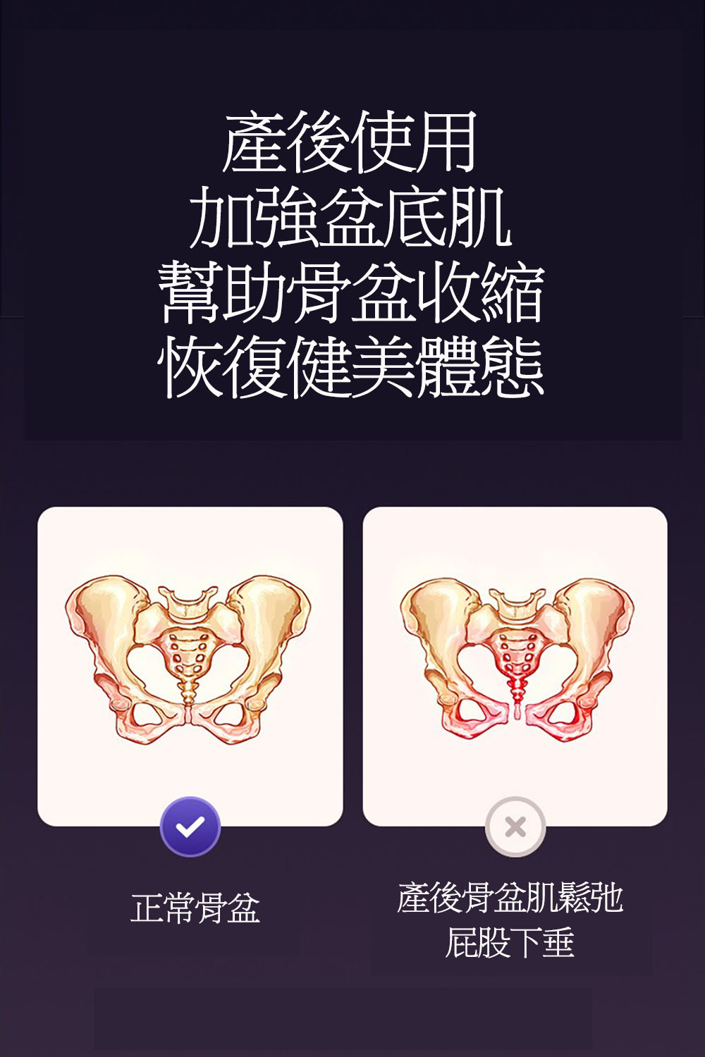 大腿美腿器(盆底肌 骨盆肌 大腿內側 夾腿器)好評推薦