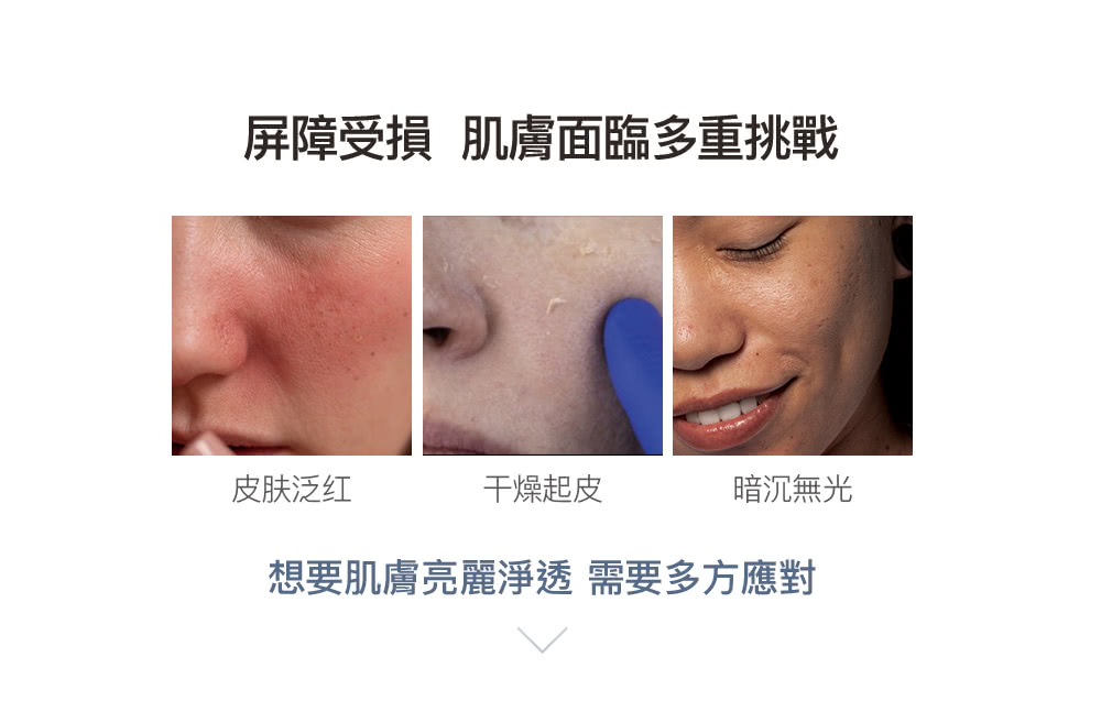 屏障受損 肌膚面臨多重挑戰 皮肤泛红 干燥起皮 暗沉無光 想要肌膚亮麗淨透 需要多方應對 