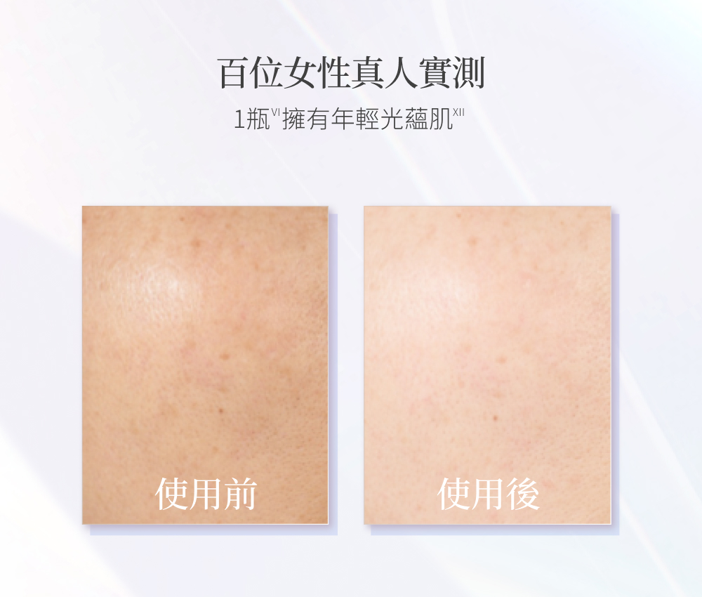 百位女性真人實測 1瓶擁有年輕光蘊肌 使用前 使用後 