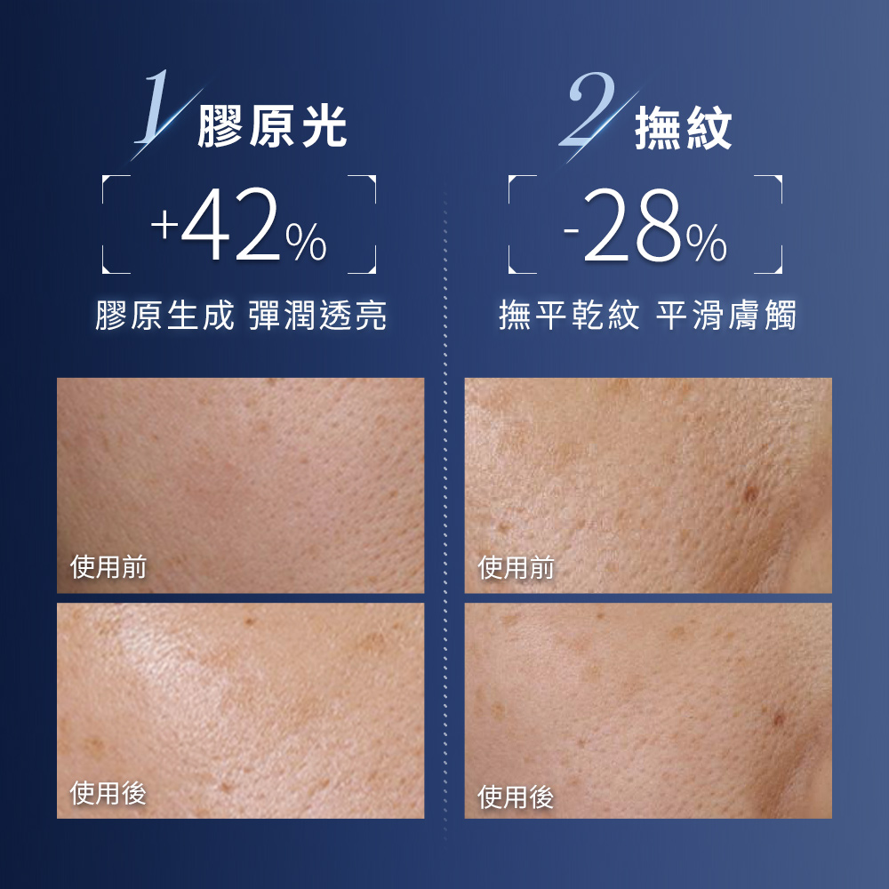 膠原生成 彈潤透亮